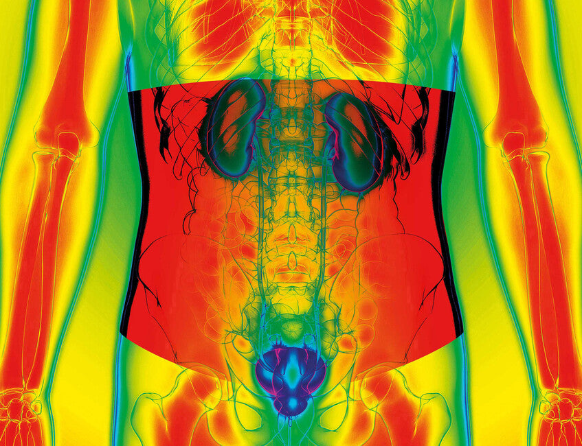 Kidneykaren Kidney Belt Cold Weather